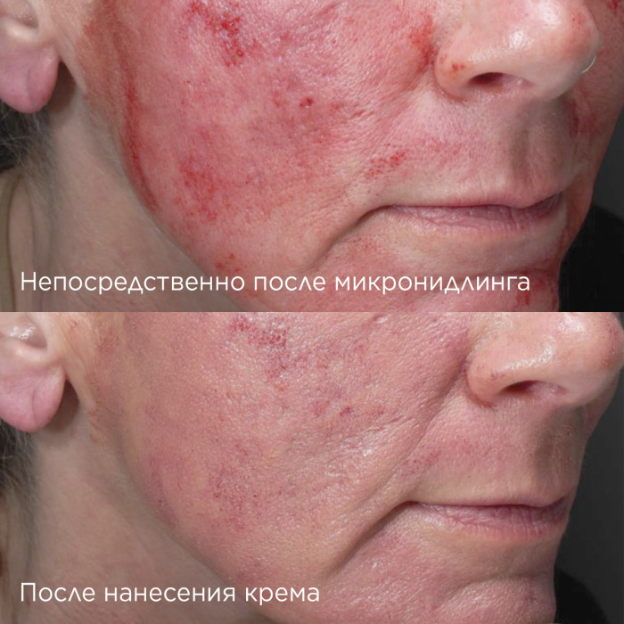 Усиленный смарт-крем SPF 50+ DAILY PREVENTION Advanced Smartblend Mineral Moisturizer