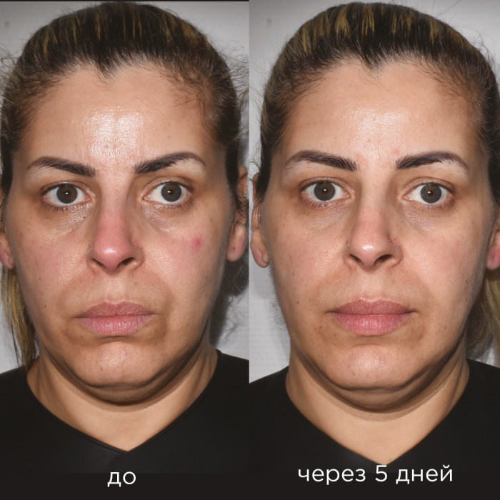 Сыворотка C20 Serum C20